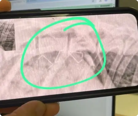 Nietjes in Röntgenfoto van hond Koda