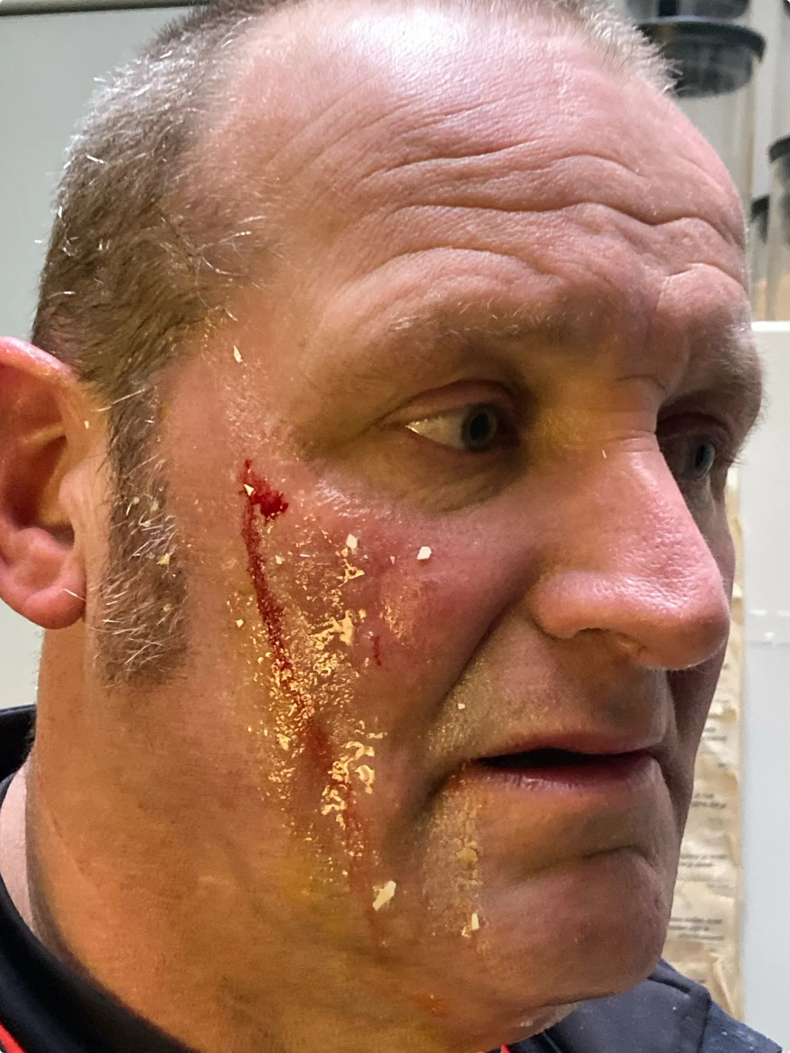 Marco Arkesteyn vlak na het jongste voorval met ei op zijn gezicht